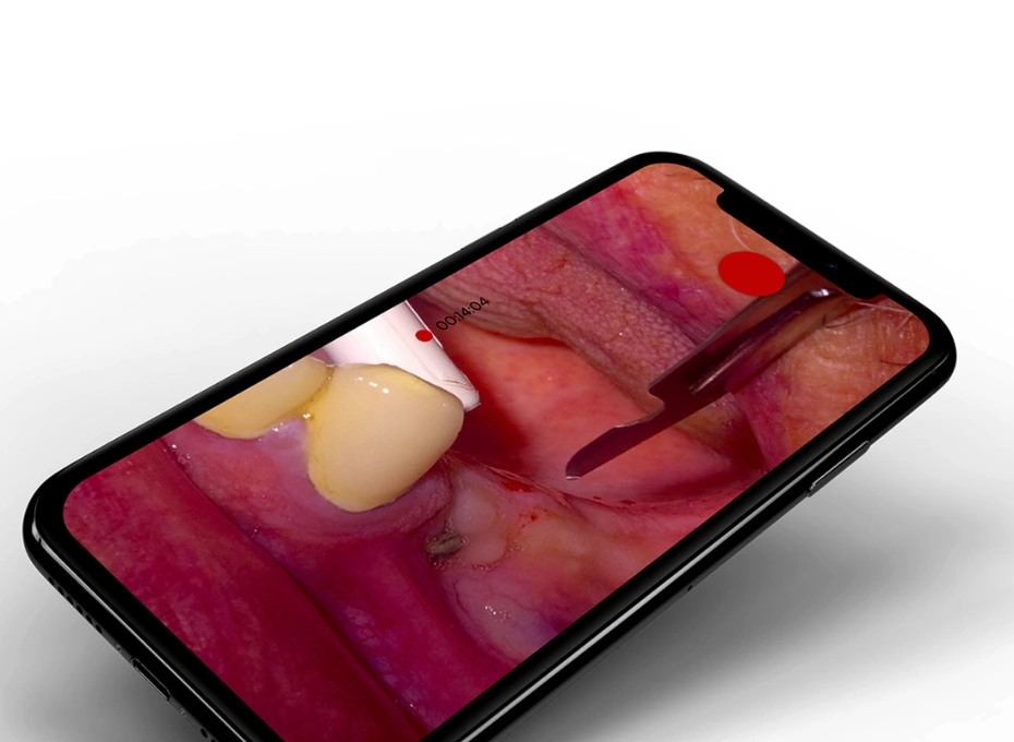 OXO Cam app preview