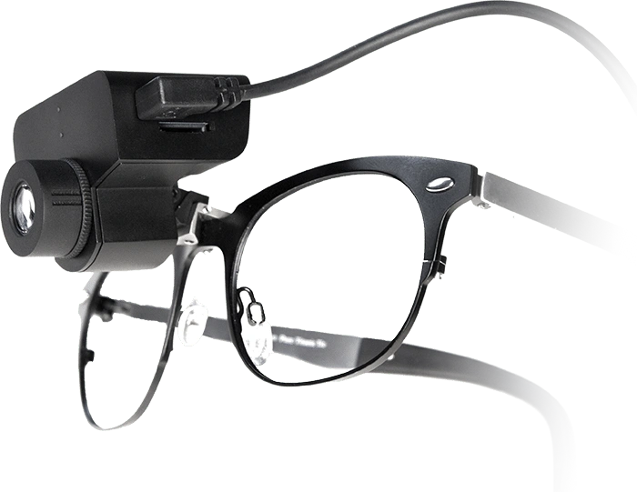 OXO 4K camera mounted on loupe. POV dental recording